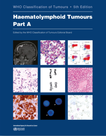 Haematolymphoid Tumours